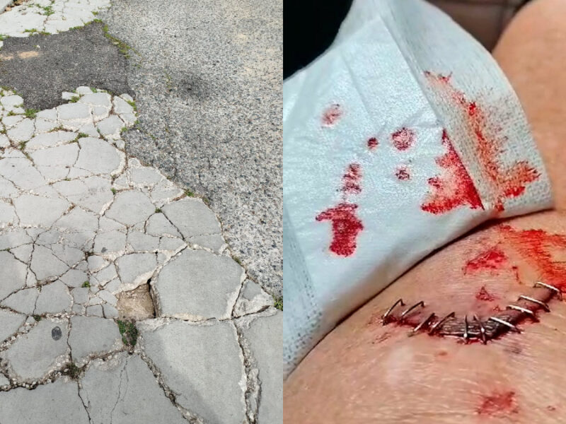 Mujer herida tras una caída en los Pinos por el mal estado de la calzada - Cedida